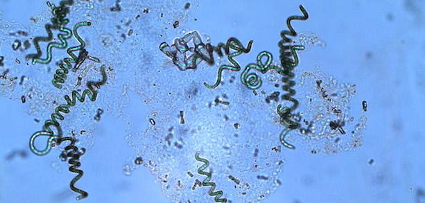 La spiruline (Arthrospira inoculum), est une cyanobactérie photosynthétique et l’un des plus petits, plus anciens et plus robustes organismes vivant sur Terre. Les cyanobactéries produisent environ 60 % de l’oxygène sur Terre. Au microscope, la bactérie ressemble à une petite spirale verte, d’où sous nom 'spiruline'.