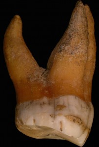 Molaire du Néandertalien Spy I, dont le tartre analysé a été prélevé en bas à droite  © IRSNB