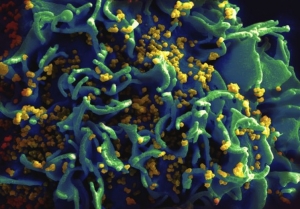 Le virus HIV infecte un lymphocyte T © NIAID