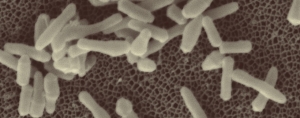 Bacilles de la tuberculose en microscopie électronique à balayage. © Jean-Pierre Tissier et Franco Menozzi (Institut Pasteur de Lille)