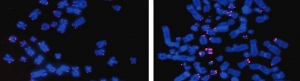 Visualisation des télomères de cellules humaines à l’aide d’une sonde fluorescente. Les chromosomes apparaissent en bleu, les télomères en rose.