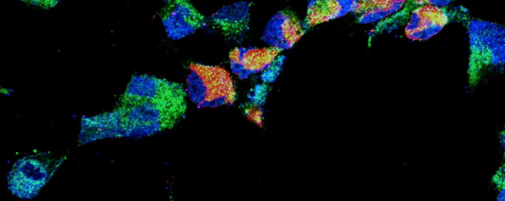 Immunomarquages de progéniteurs neuronaux humains (Nestin,vert; Sox2, bleu) infectés avec le virus ZIKA (NS1, rouge).
