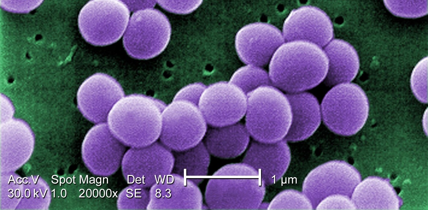 Biofilms : une stratégie innovante pour renforcer l’efficacité des antibiotiques